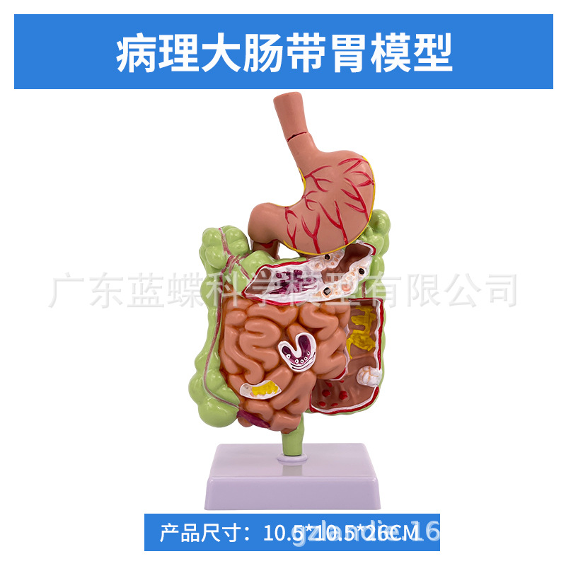 ��ѧ��������󳦲���ģ�ͳ�θֱ���̴�������ʳ��������᳦����