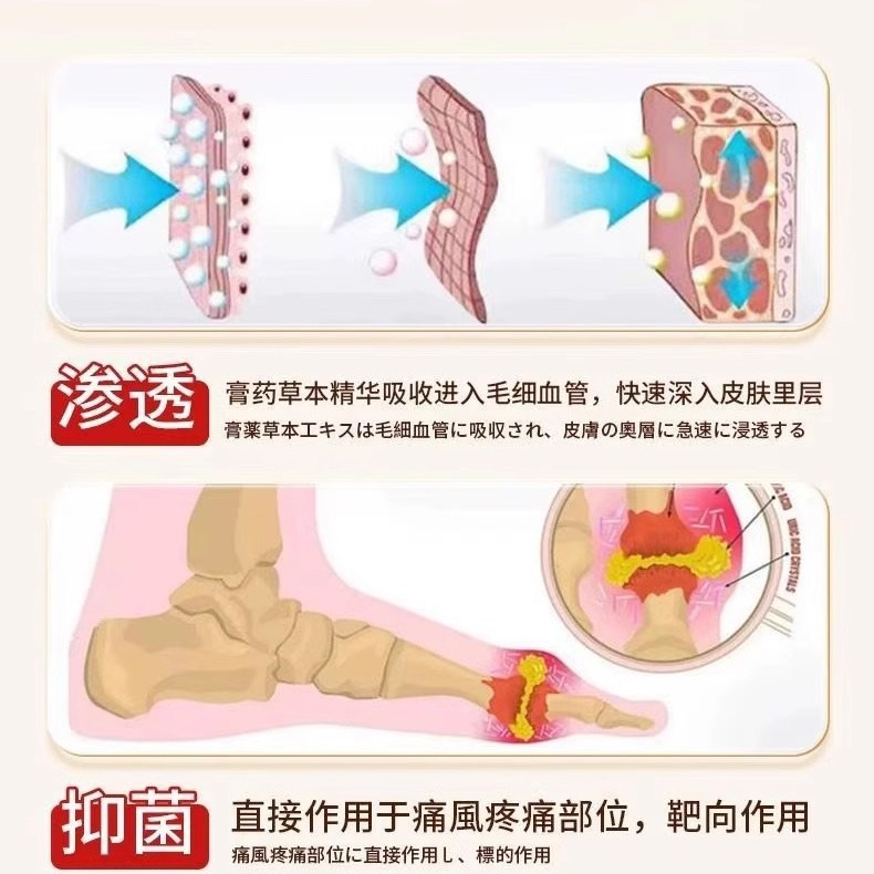 痛风远红外骨痛膏药贴尿酸肿痛关节疼溶缓解疼痛修复官方现货代发|undefined