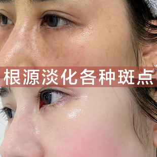 �f��˪ȫ����������˪�o�¿������۰ױ����o�w��ɫ��Ч��˪