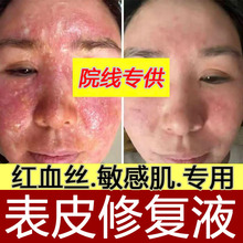 �����ޏ;��AҺ�澏���t���|�����м��˼t��������ԺҺ�B�ޏ�ԭҺ