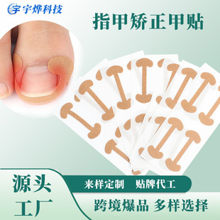 Toenail Correction Patch, Toenail Groove Patch, Onychomycosis Nail Damage Foot Care Patch, Nail Correction Patch