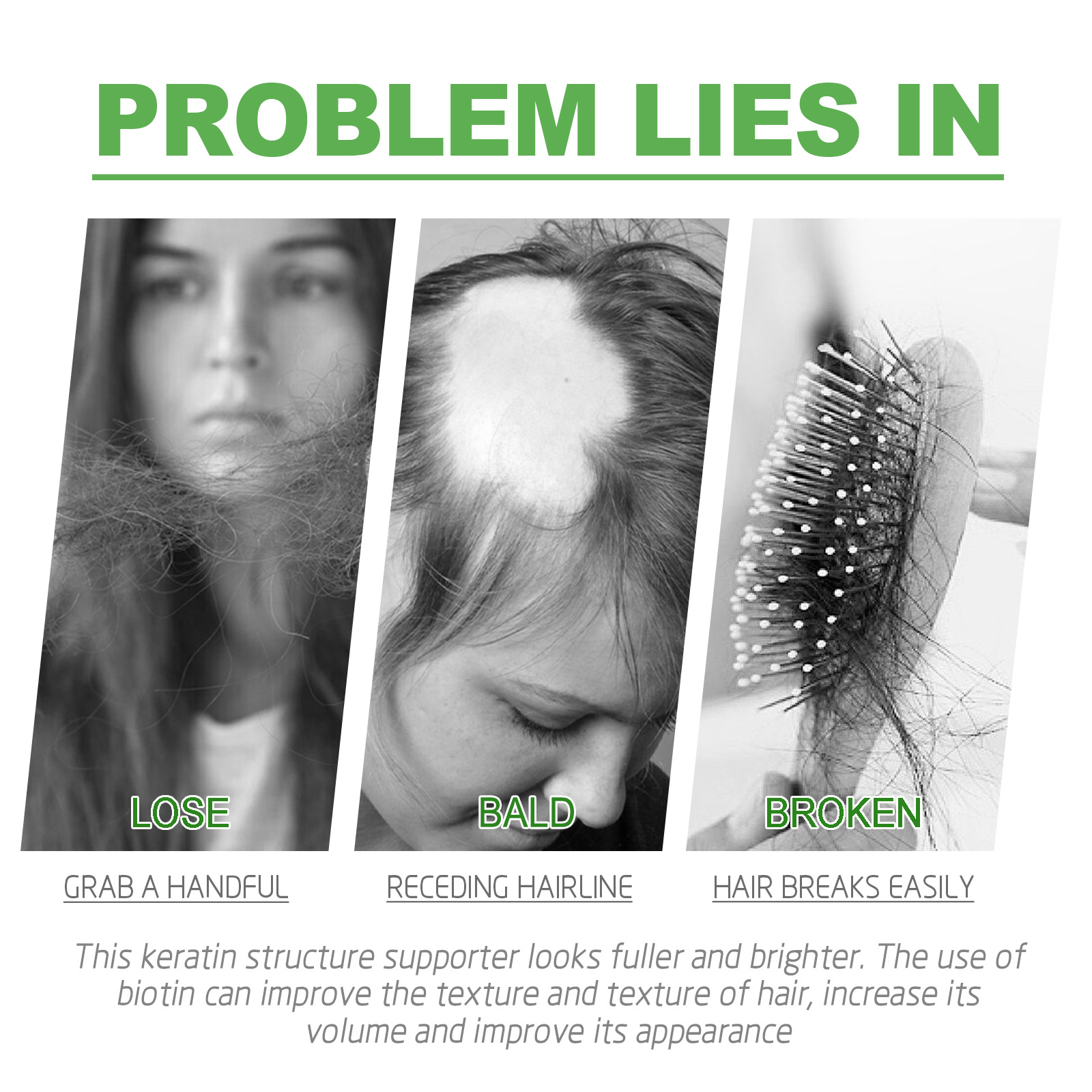 Las cápsulas capilares de jengibre EELHOE nutren las raíces del cabello, nutren y espesan el cabello, fortalecen y previenen la caída del cabello, cuidan el masaje del cuero cabelludo_voghion.com