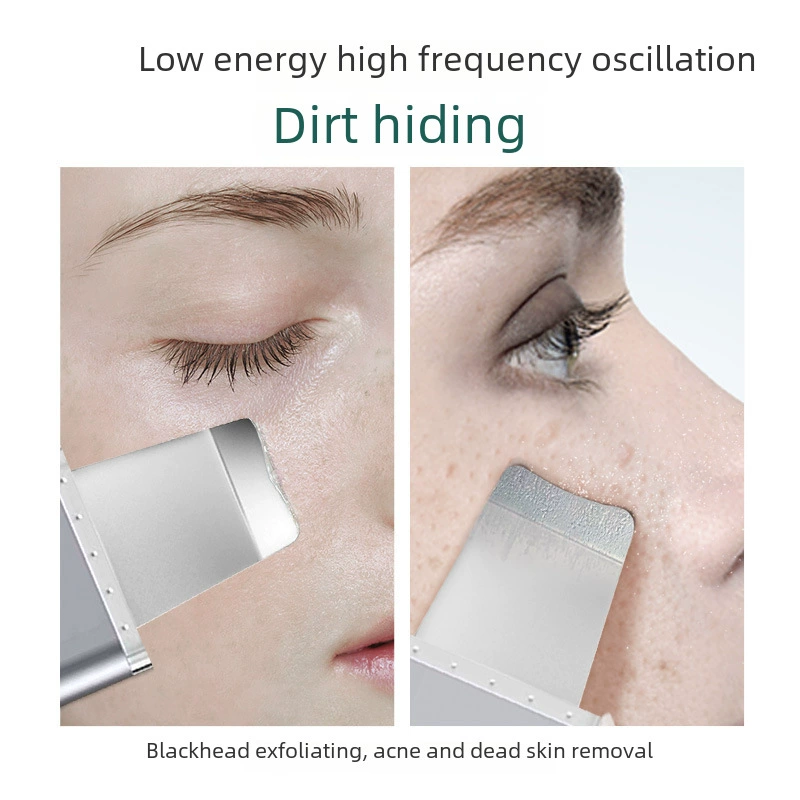 Shooping machine Pore cleaning device Face Instrument Go to Acne Horny Horn Black Head Shovel, Blackhead Instrument Vibration and Heating