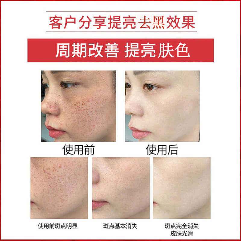 377 ホワイトニング エッセンス、保湿、保湿、濃い黄色、肌のトーンを改善、美白、そばかす除去、高濃度ナイアシンアミド オリジナル ソリューション|undefined