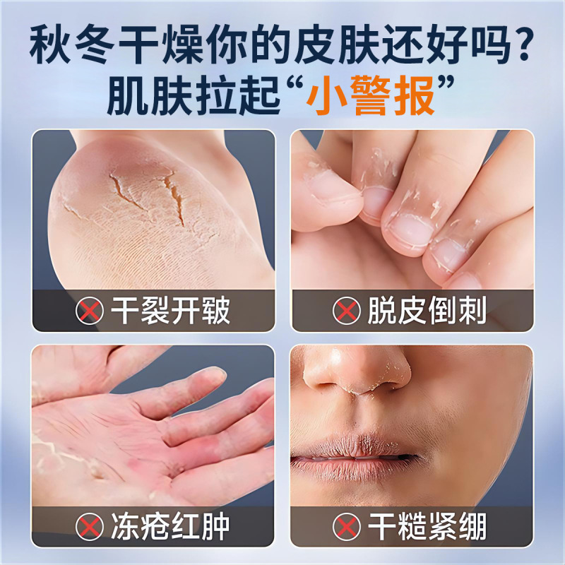 吟美裂可寧霜防凍防裂秋冬修復手足乾燥補水保湿潤肌爆金メーカー卸売り|undefined