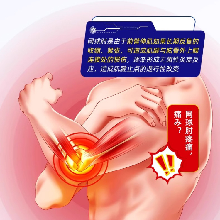岩京宏テニス肘特別な肘パッド石膏腕肘関節痛しびれ石膏工場直接販売|undefined