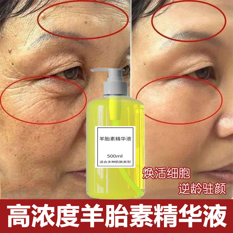 羊プラセンタエッセンスは小じわを薄くし、引き締め、しわ防止、保湿、アンチエイジング美容室液体エッセンス|undefined
