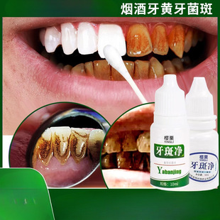 Teeth Wipe to Remove Tartar, Quick Cleaning Effect to Remove Yellow and Black Dental Calculus, Tea Smoke Stains, Plaque and Plaque Removal Device