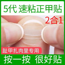 速粘正甲贴片套装嵌甲贴速粘条矫正器正甲丝正甲扣正甲贴厂