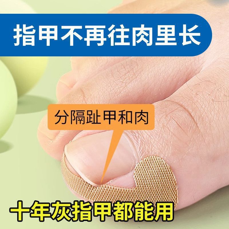 New Glue-Free Nail Patch for Toenails, Nail Groove Ingrown Toenail Orthosis, Toenail Patch for Manicure New Glue-Free Nail Patch for Toenails, Nail Groove Ingrown Toenail Orthosis, Toenail Patch for Manicure
