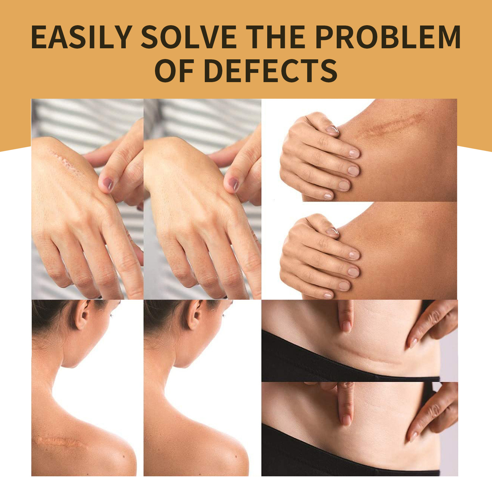 Invisible Concealer Patch For Skin Scars And Tattoos_voghion.com