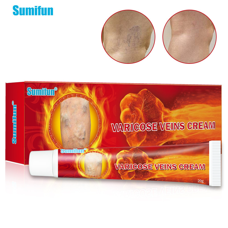 sumifun yeso transfronterizo amazon crema venosa maikang unguento maili shu lombrices piernas unguento vascular mayorista