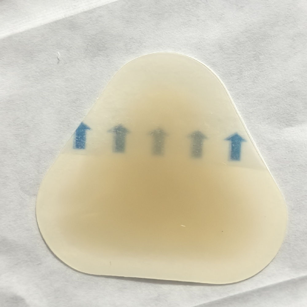 4.5*4.1cm 하이드로콜로이드 반창고