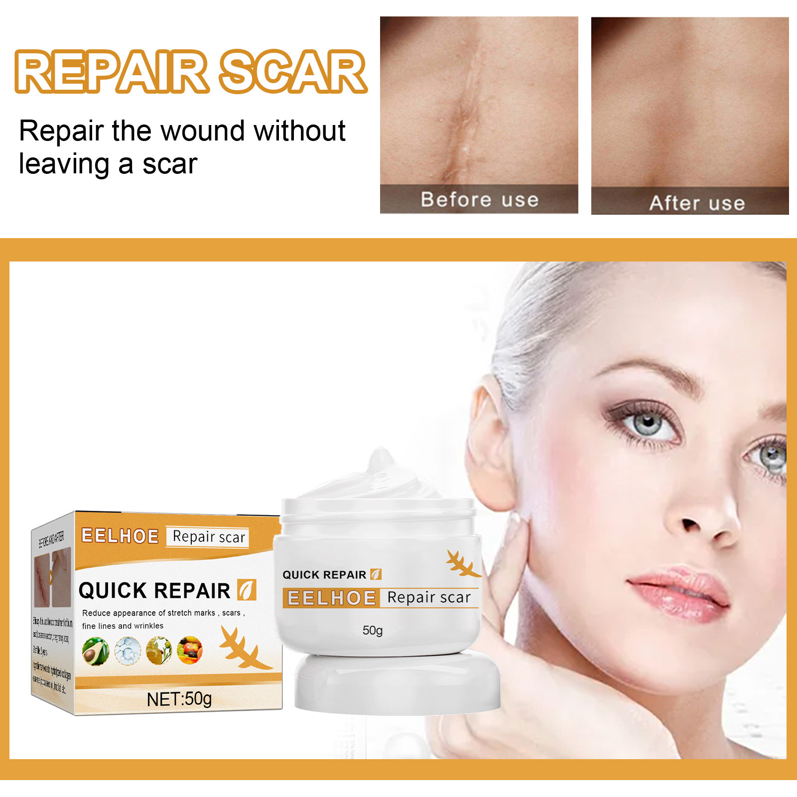 EELHOE Scar Cream Fading Hud Trauma Reparation Forbrænding Forbrænding Fading Cream Kirurgisk reparation Scar Scar Cream_voghion.com