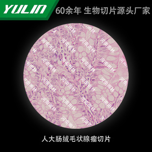 �˴��c�që��������Ƭ��У�t�WԺУ�ýM������ʯϞ��Ƭ�˱��@΢�R