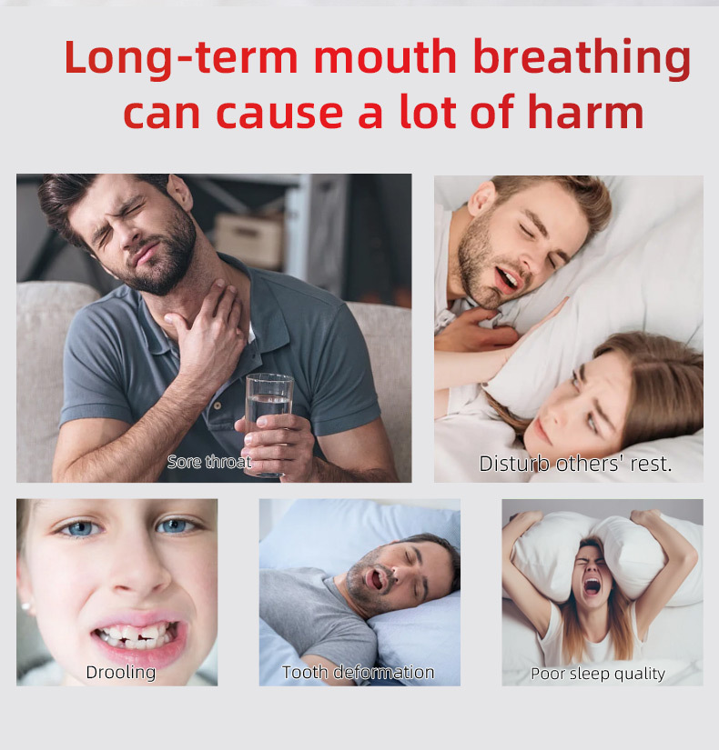 Mouth Breathing Correction Patch Anti Snoring Sleep Strip 30 Patches Box key features
