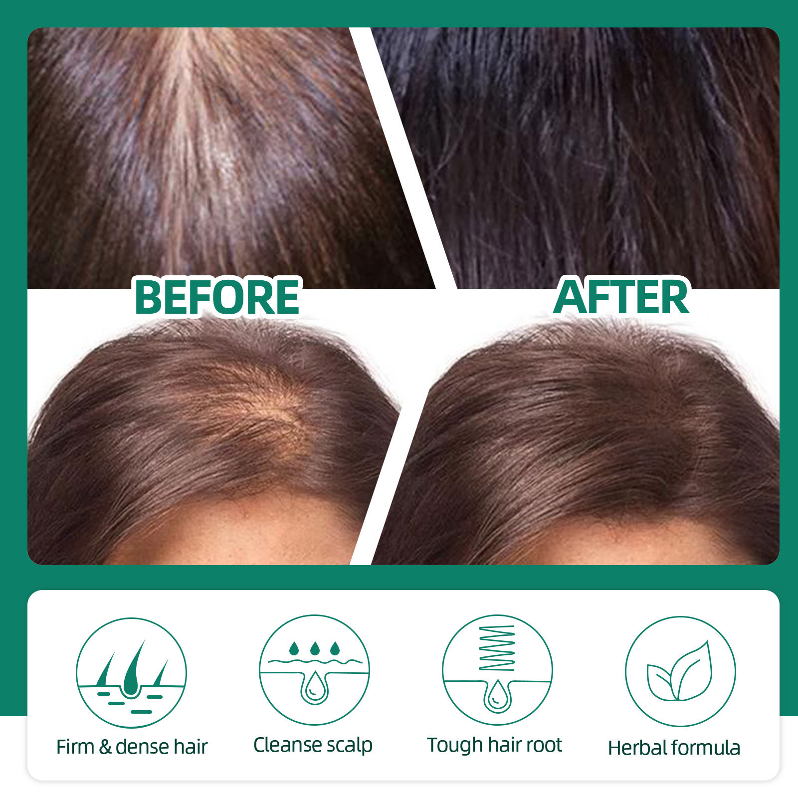 Herbal West&Month losjooni essents niisutab, et vältida tihedat juuste väljalangemist_voghion.com