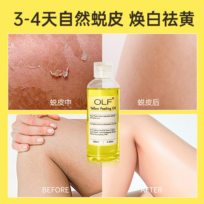 Aceite de peeling amarillo transfronterizo