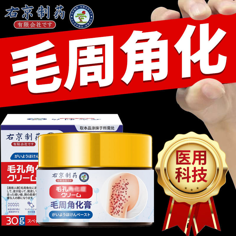 右京製薬 鶏の皮膚のニキビ毛包角化軟膏 毛周角化症非症候群 子供用ボディローション 角質|undefined