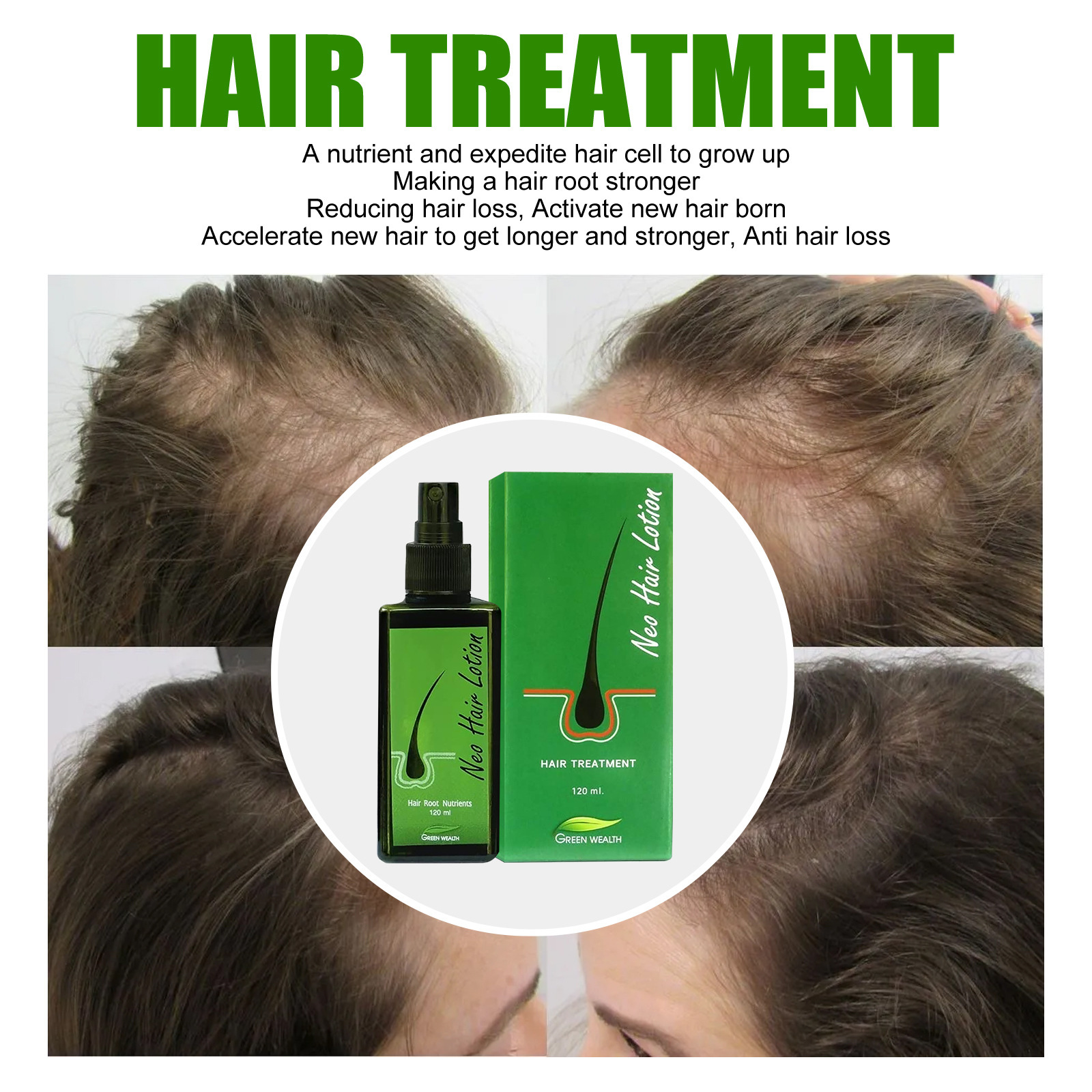 Long Lotion spray Nourishing Scalp Toughening Moisturizing Dense Hair Care Liquid_voghion.com