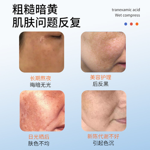 iOEO tranexamic acid wet compress 100ml dull melanin brightening tranexamic acid essence wet compress water wholesale