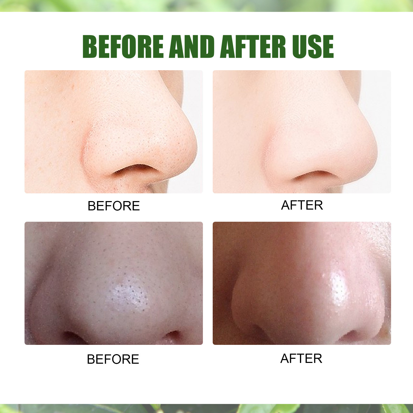 EELHOE Green Tea Pore Shrinking essence Solution Moisturizes, moisturizes, gently shrinks, refines pores, revitalizes_voghion.com