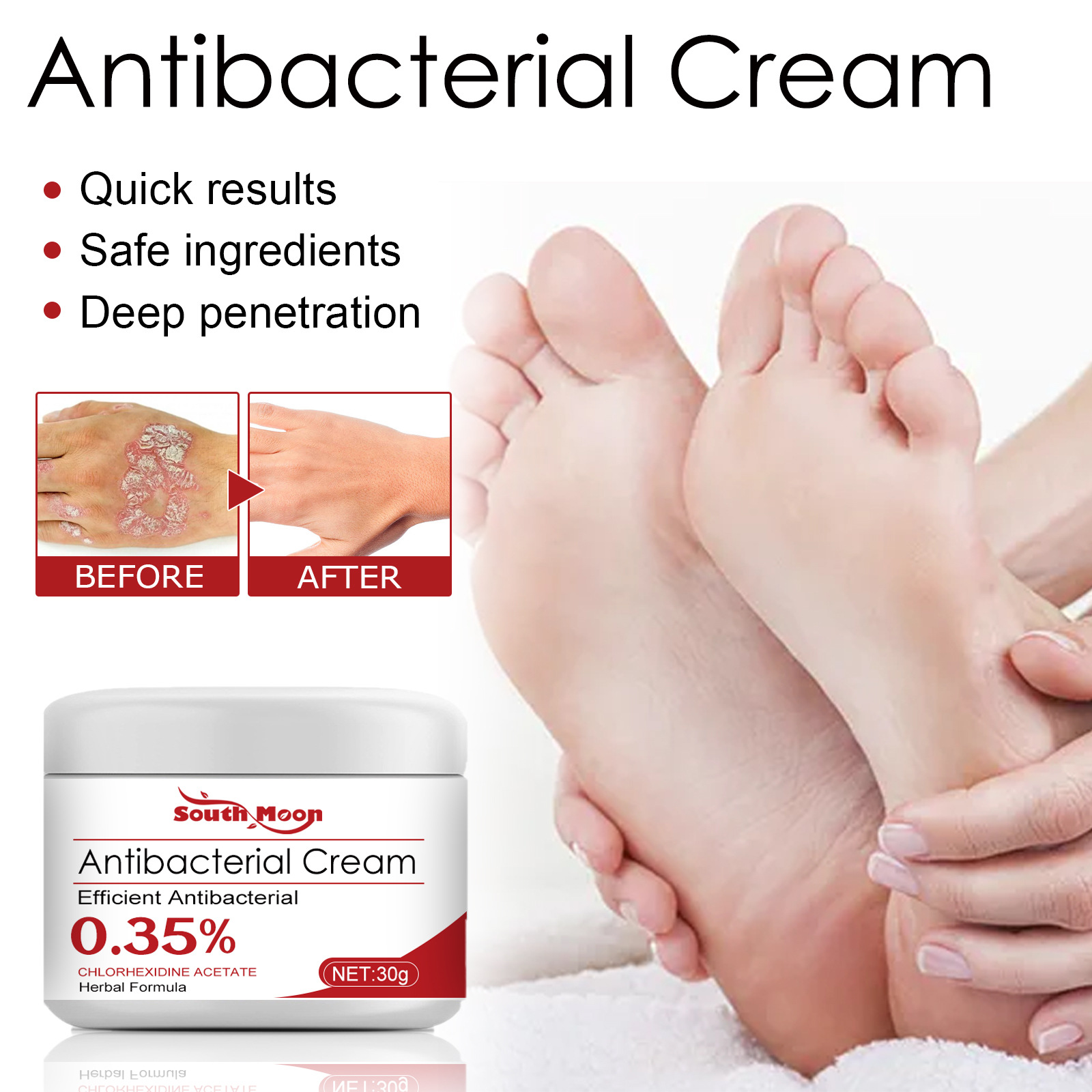South Moon Psoriasis Care Cream Zarudnutí pokožky těla, svědění, krém proti svědění a lupénce na rukou a nohou_voghion.com