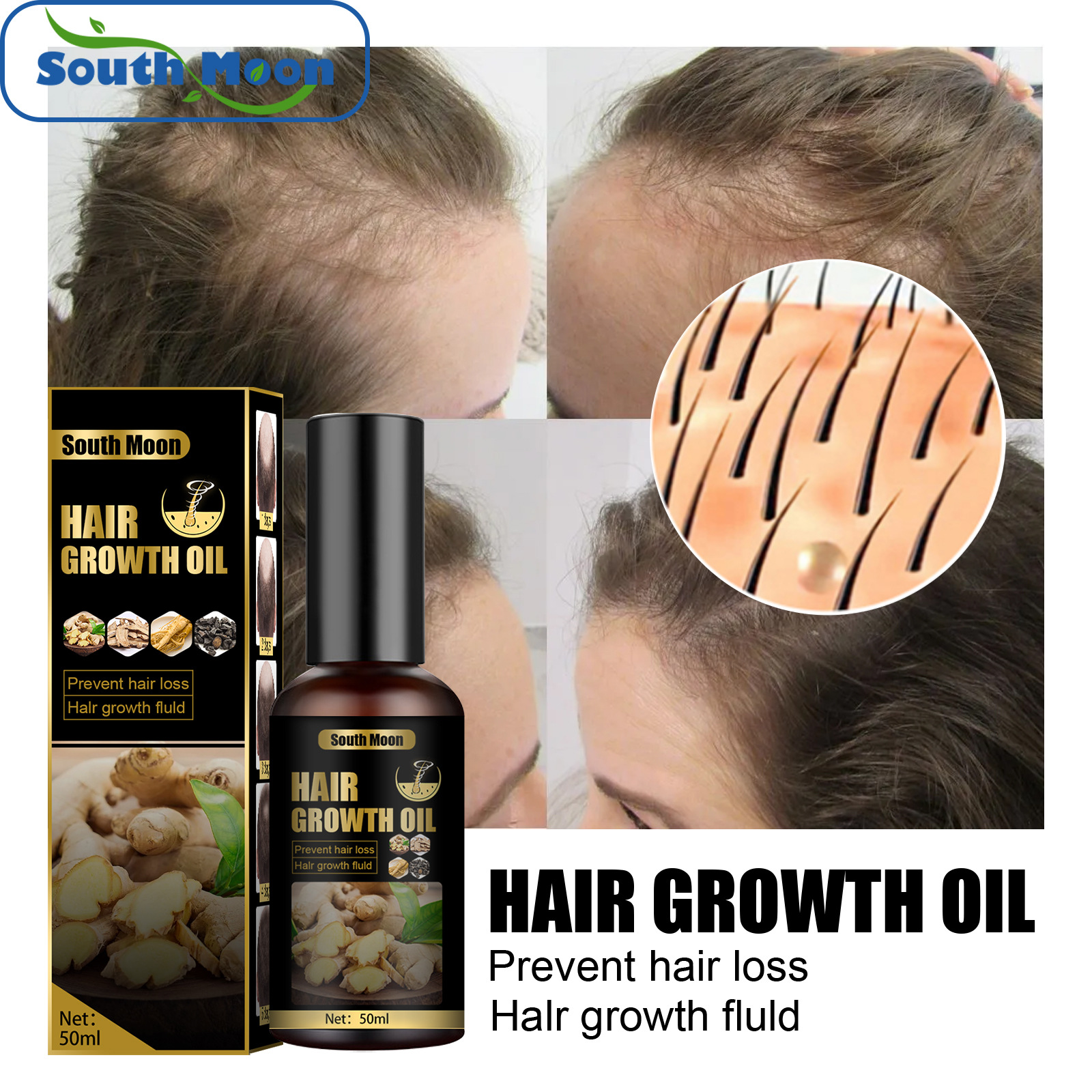 South Moon Loss Lotion Anti-Verlust, starke und robuste Qualität, dichtes Haar, Nährstoffreparatur_voghion.com