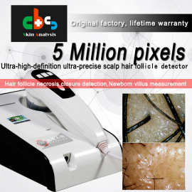 跨境5 million pixel high-definition scalp Hair detector Test
