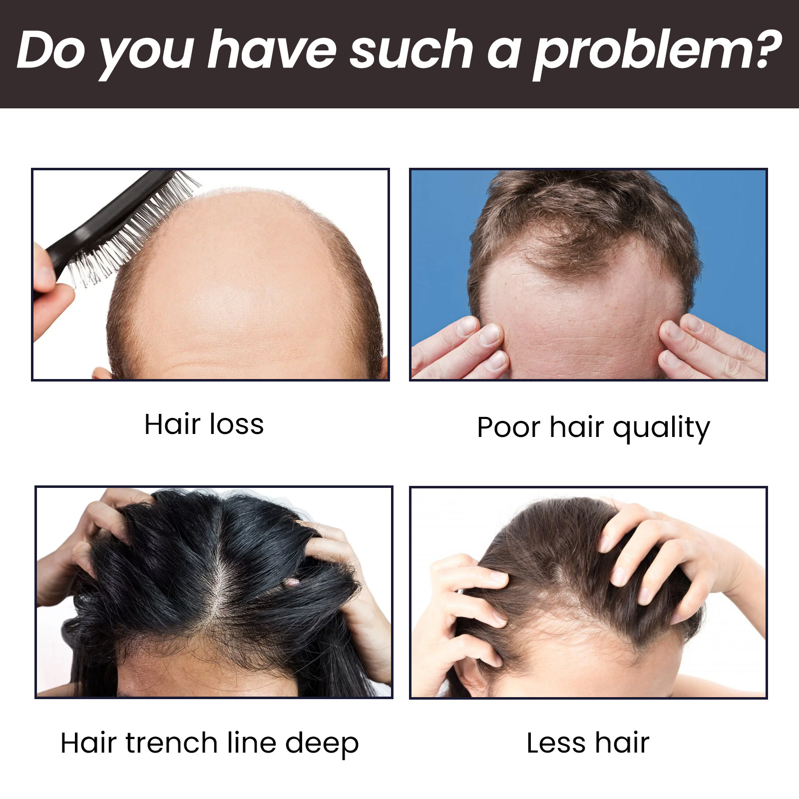 OUHOE Biotin Moisturizing Root Dense Repairing Hairline Strong and Firm Hair Essence_voghion.com