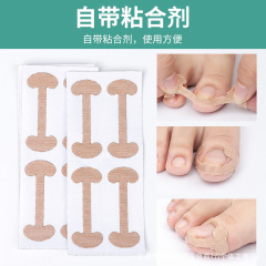 脚指甲贴工字形贴片甲沟母趾卷甲贴片快速修脚趾甲变形嵌足矫正器