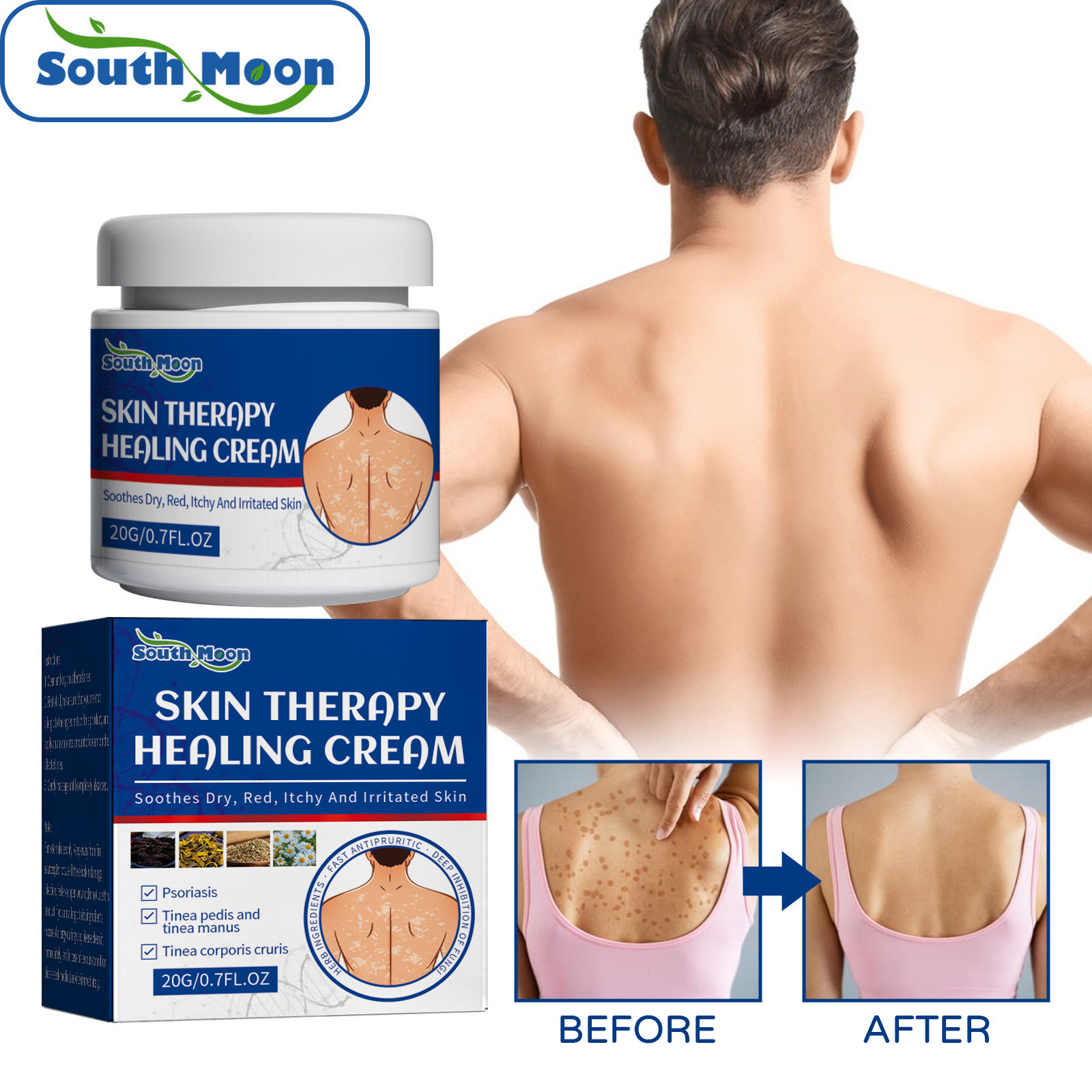 South Moon Skin Repair Cream for Relieving Itching Body Redness Itching Repair Skin Moss Skin Topical Ointment