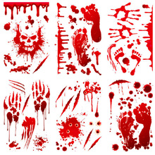 Ѫ��ӡ��Ѫ܇�N ������Ѫ���₀�Ի����b��f�}��܇���NR532