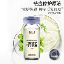 ȥoAҺtpٴֲowƷ|÷owƷͨԭҺ