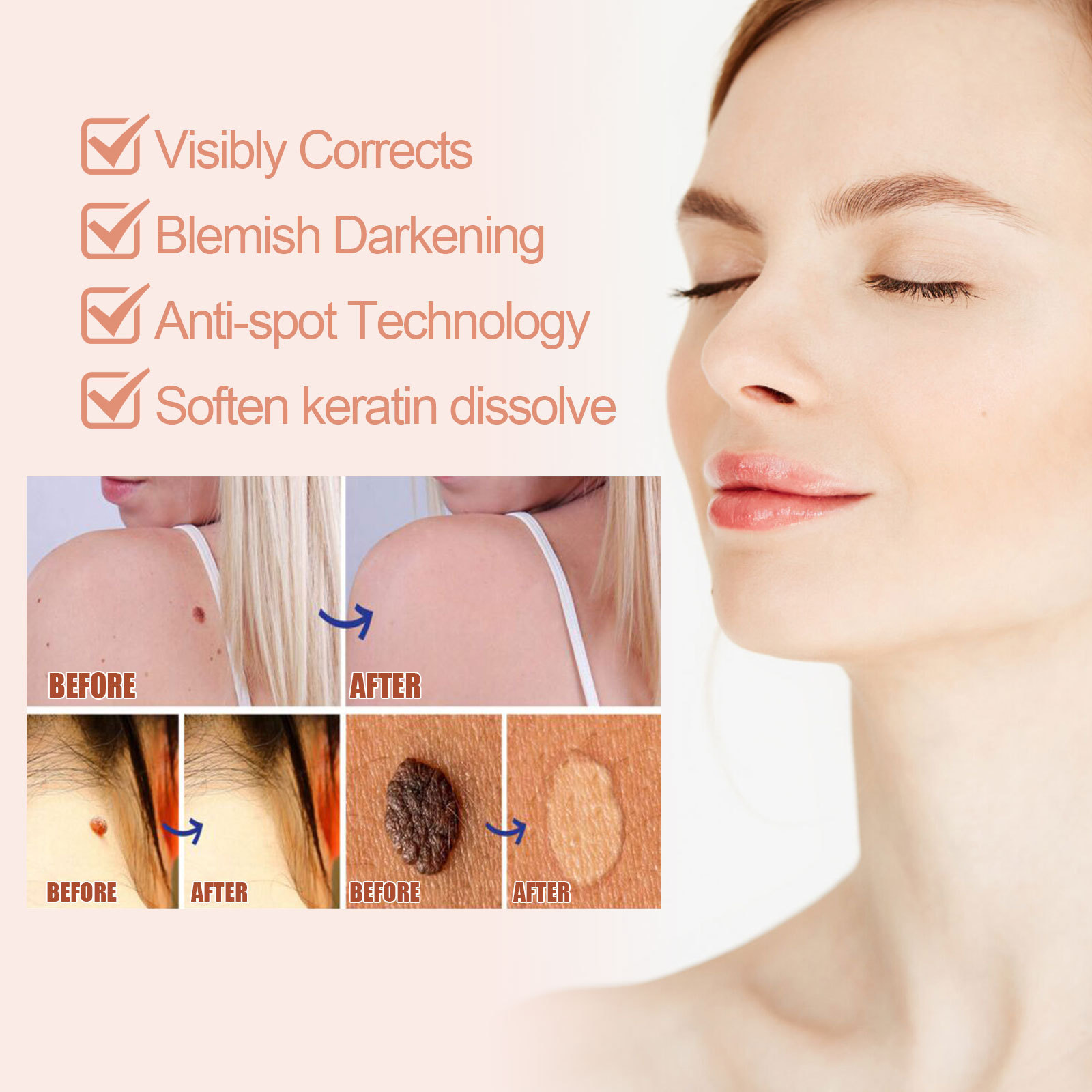 EELHOE for skin repair, body care, hands, feet, face, and underarm wart cream_voghion.com