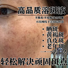 �o���ܰ�Һ��ÓƤ���߾��AҺ����Ժȥȸ�ߕ���S�ְ���Ƥ�����Һ