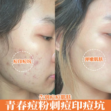 �ݱ��ԭҺ������ӡ�����ഺ������ë���ޏ�Һ����Ժ����AҺ