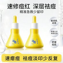 兰色素心大灯泡控油祛痘精华液淡化痘印青春痘保湿舒缓泛红祛痘水