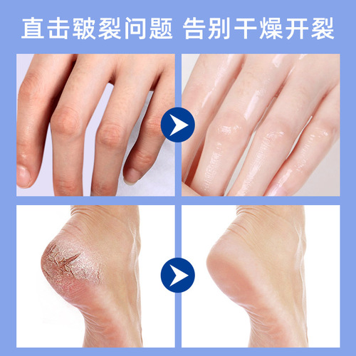 XIUSE Xiu Se Vaseline Moisturizing and Repairing Cream for Dry Cracks Prevention 