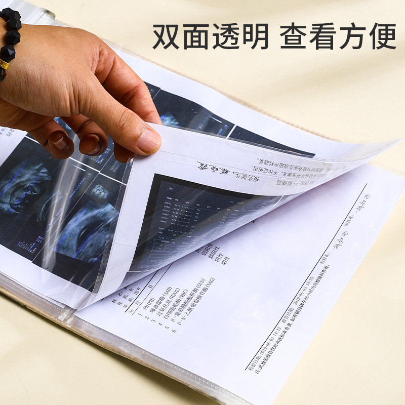 A5 임산부 휴대용 산부검진 A4B 초음파 단일 임신 검진 보관책 임산부 임신 보고서 단일 데이터북