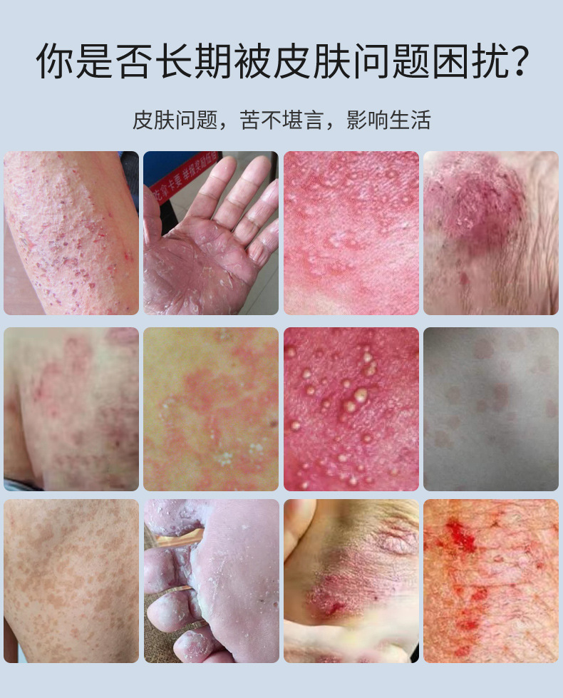Bai Xiao Ning Herbal Cream External Skin Application 30g Red Bottle quality and texture