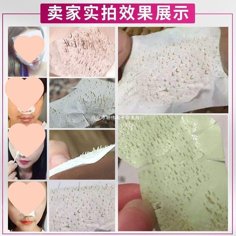 泰国去黑头 芦荟胶撕拉式祛黑头水男女学生粉刺闭口清洁鼻贴|undefined