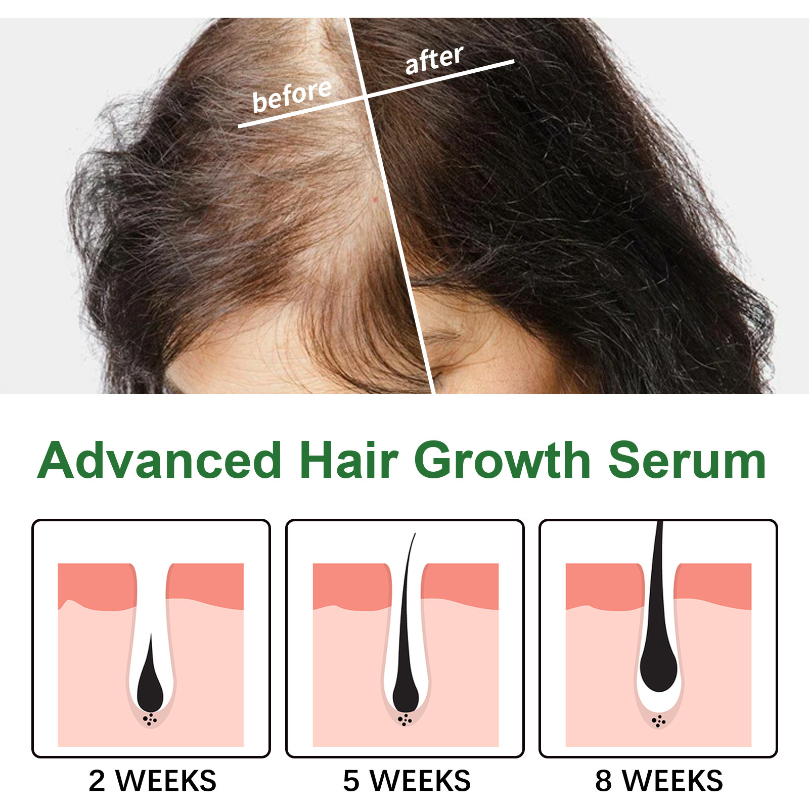 EELHOE Hair Essence Spendet Feuchtigkeit für die Haarwurzeln, pflegt die Kopfhaut, sorgt für kräftiges Haar, beugt Haarausfall vor und verdickt das Haar_voghion.com