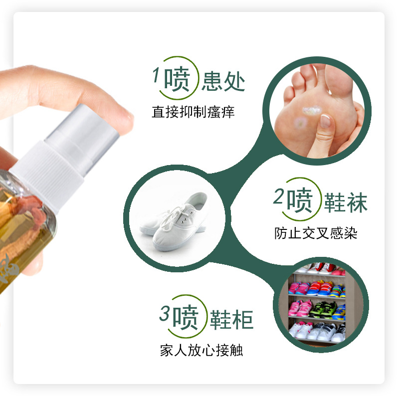Jintaikang ginseng athlete's foot spray 30ml herbal anti-itch athlete's foot water smelly feet, sweaty feet, athlete's foot spray wholesale