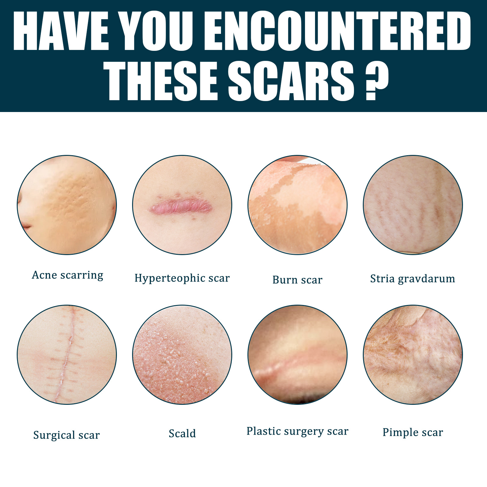 EELHOE 淡化疤痕凝胶 手术伤疤皮肤增生烧烫护理抚痕平滑修护伤痕详情6