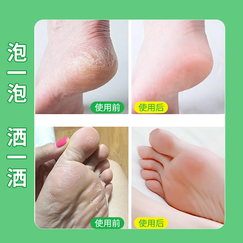 厂家批发散艾草足光粉 汗脚臭脚泡脚足散 脚丫爽粉脚臭粉足光粉|undefined
