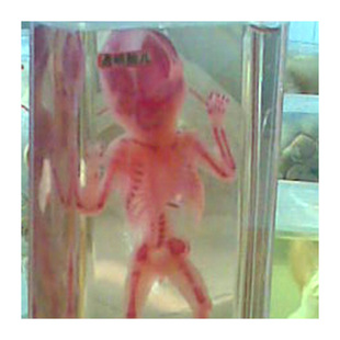 Human Anatomical Model Class Transparent Fetal Model, Embryo Model, Nursing Teaching Model