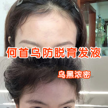 ���מ����lҺ���^�lҺ�^�l���L�ޏ�ë�ұ���l�H����Ó�̰l�����A