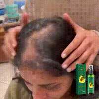 Cheveux denses East Moon pour prévenir la perte, hydratation ferme, cheveux forts et épais, massage du cuir chevelu, spray de soin capillaire_voghion.com