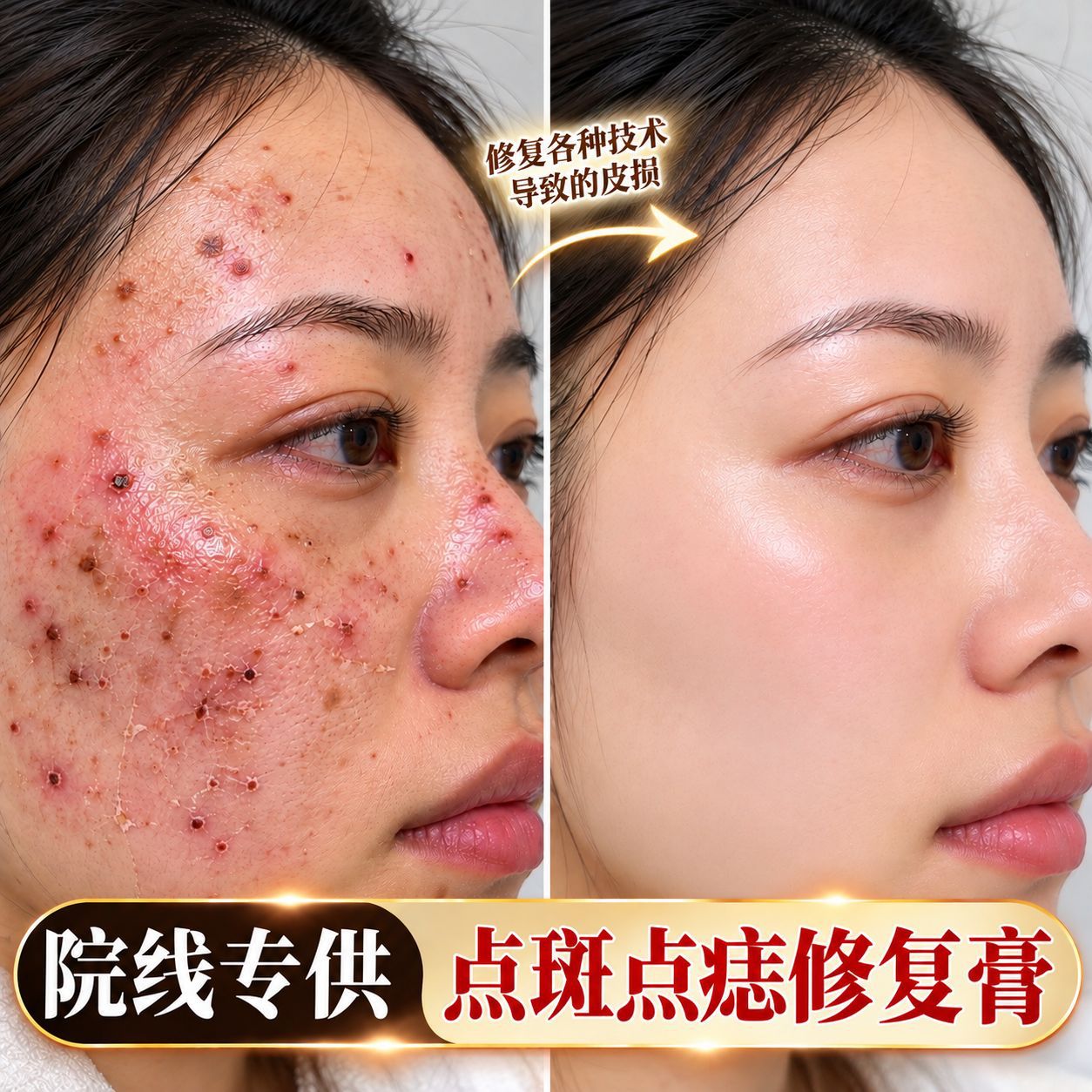 修复肽脸部激光后点痣点斑后红印退红缓解激素脸修复敏感肌修复膏